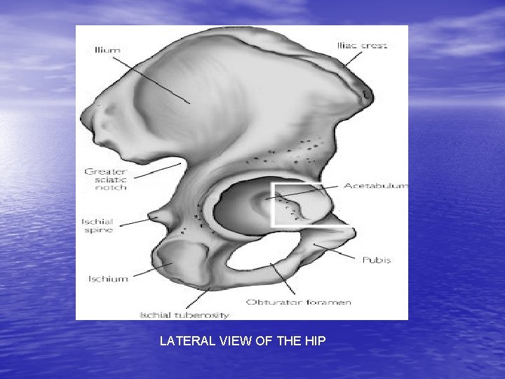 LATERAL VIEW OF THE HIP 