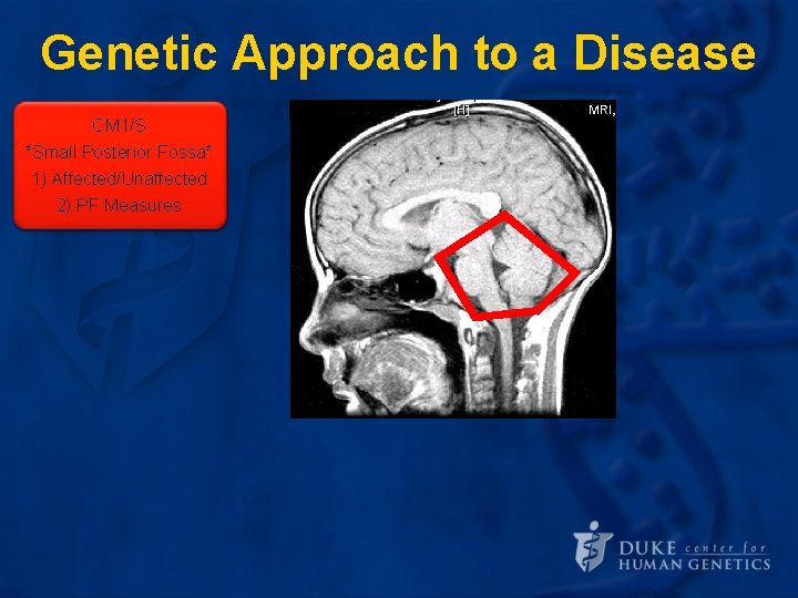 Genetic Approach to a Disease CM 1/S *Small Posterior Fossa* Define the 1) Affected/Unaffected Genetic Approach to a Disease CM 1/S *Small Posterior Fossa* Define the 1) Affected/Unaffected