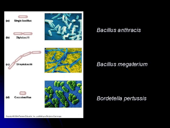 Bacillus anthracis Bacillus megaterium Bordetella pertussis 
