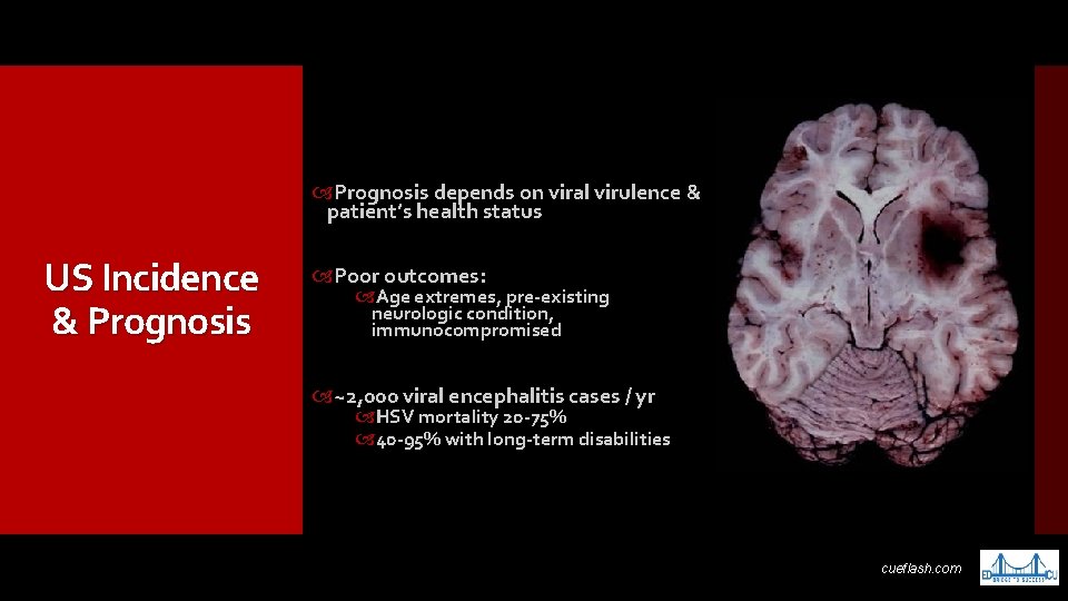  Prognosis depends on viral virulence & patient’s health status US Incidence & Prognosis