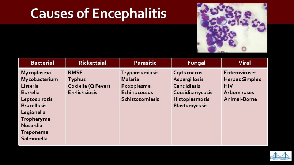 Causes of Encephalitis Bacterial Mycoplasma Mycobacterium Listeria Borrelia Leptospirosis Brucellosis Legionella Tropheryma Nocardia Treponema