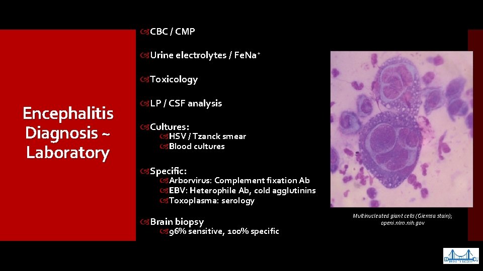  CBC / CMP Urine electrolytes / Fe. Na+ Toxicology Encephalitis Diagnosis ~ Laboratory