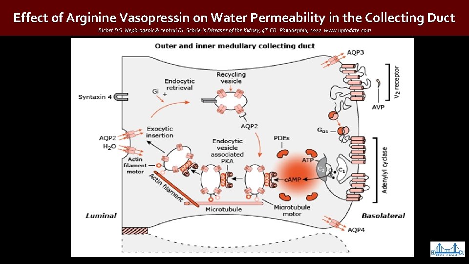 Effect of Arginine Vasopressin on Water Permeability in the Collecting Duct Bichet DG. Nephrogenic