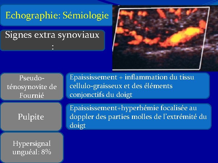 Echographie: Sémiologie Signes extra synoviaux : Pseudoténosynovite de Fournié Pulpite Hypersignal unguéal: 8% Epaississement