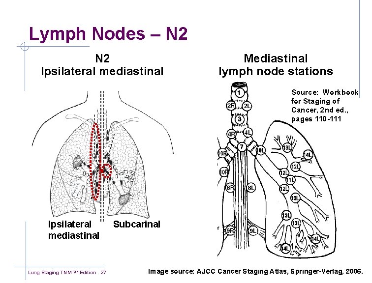 Lymph Nodes – N 2 Ipsilateral mediastinal Mediastinal lymph node stations Source: Workbook for