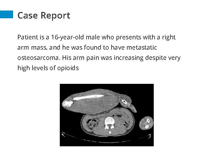 Case Report Patient is a 16 -year-old male who presents with a right arm Case Report Patient is a 16 -year-old male who presents with a right arm