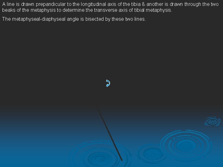 A line is drawn prepandicular to the longitudinal axis of the tibia & another