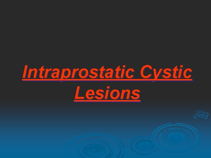 Intraprostatic Cystic Lesions 