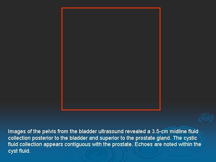 Images of the pelvis from the bladder ultrasound revealed a 3. 5 -cm midline
