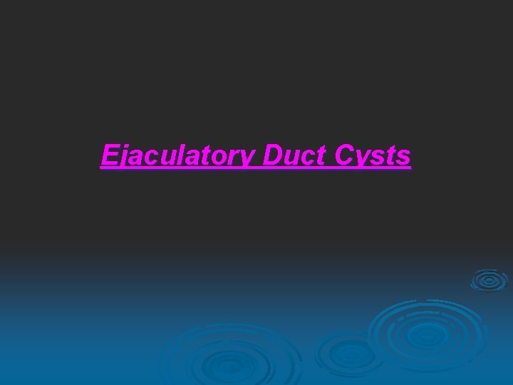 Ejaculatory Duct Cysts 