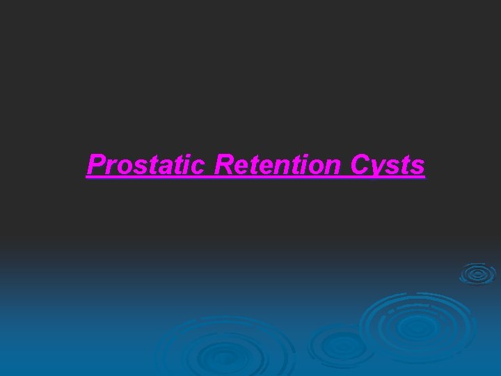 Prostatic Retention Cysts 