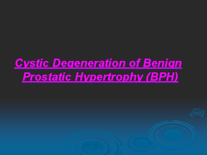 Cystic Degeneration of Benign Prostatic Hypertrophy (BPH) 