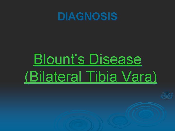 DIAGNOSIS Blount's Disease (Bilateral Tibia Vara) 