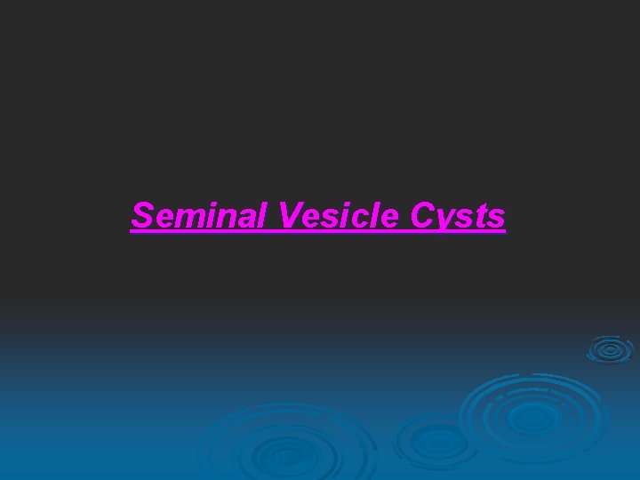 Seminal Vesicle Cysts 