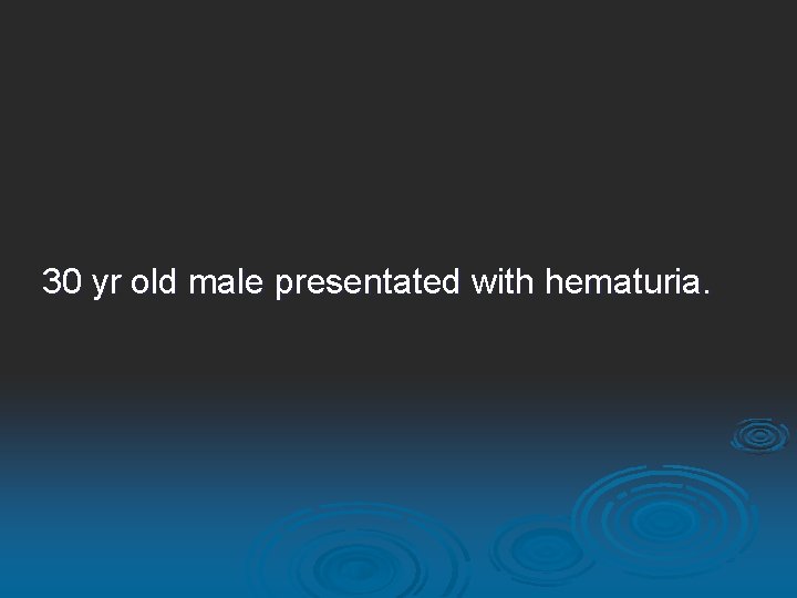 30 yr old male presentated with hematuria. 