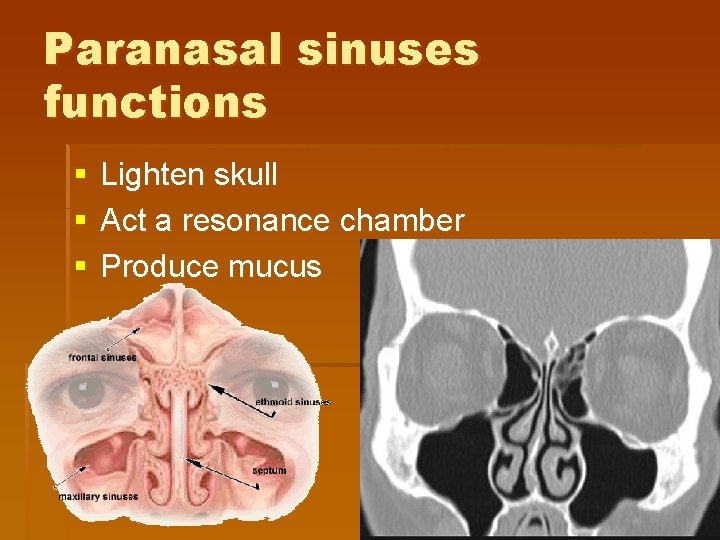 Paranasal sinuses functions § § § Lighten skull Act a resonance chamber Produce mucus Paranasal sinuses functions § § § Lighten skull Act a resonance chamber Produce mucus