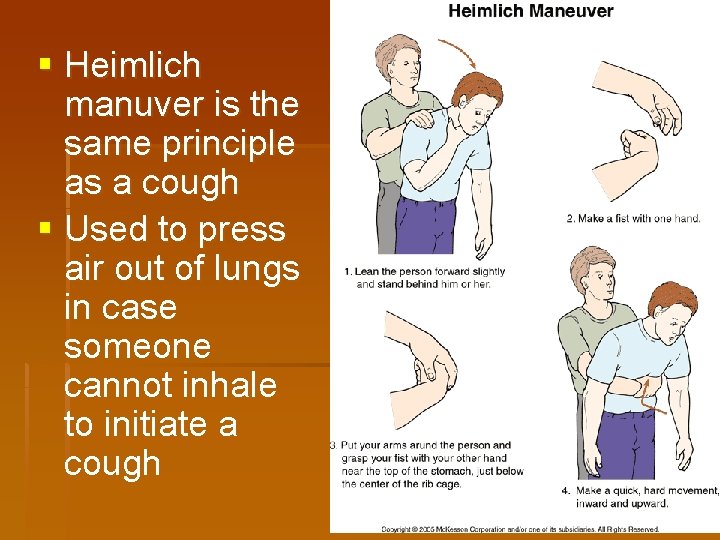 § Heimlich manuver is the same principle as a cough § Used to press § Heimlich manuver is the same principle as a cough § Used to press