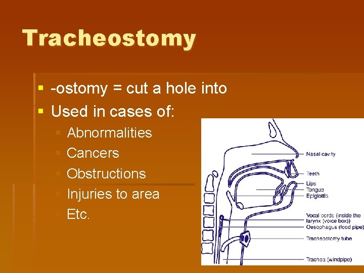 Tracheostomy § -ostomy = cut a hole into § Used in cases of: § Tracheostomy § -ostomy = cut a hole into § Used in cases of: §