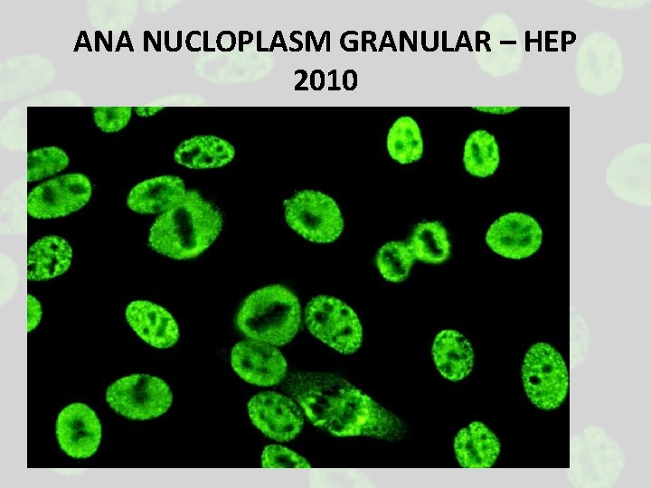 ANA NUCLOPLASM GRANULAR – HEP 2010 