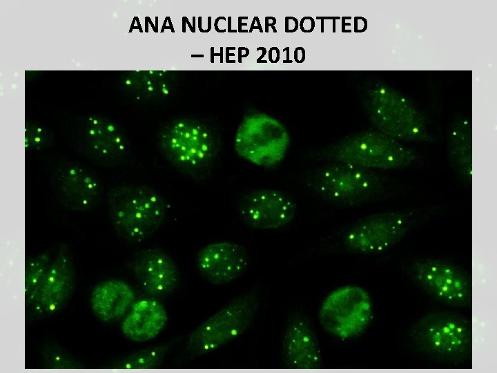 ANA NUCLEAR DOTTED – HEP 2010 