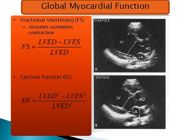 Global Myocardial Function • Fractional shortening (FS) – Assumes symmetric contraction • Ejection fraction