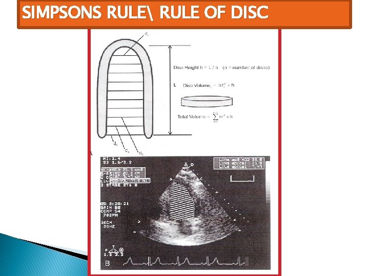 SIMPSONS RULE RULE OF DISC 
