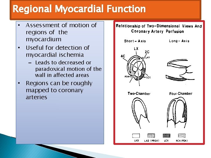 Regional Myocardial Function • Assessment of motion of regions of the myocardium • Useful