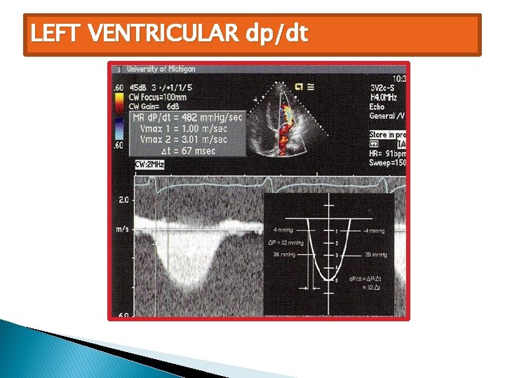 LEFT VENTRICULAR dp/dt 