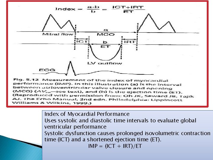 Index of Myocardial Performance Uses systolic and diastolic time intervals to evaluate global ventricular