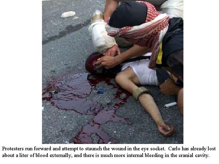 Protesters run forward and attempt to staunch the wound in the eye socket. Carlo