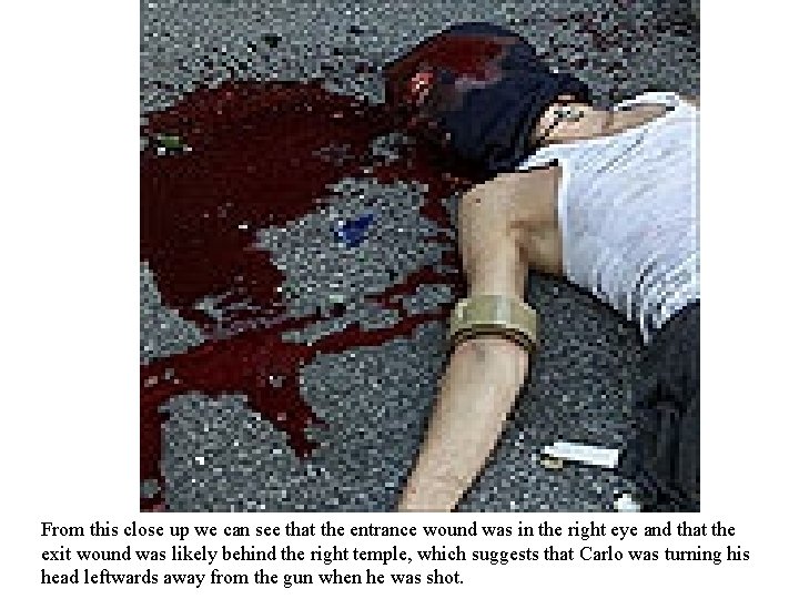 From this close up we can see that the entrance wound was in the