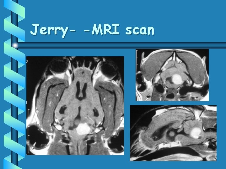 Jerry- -MRI scan 