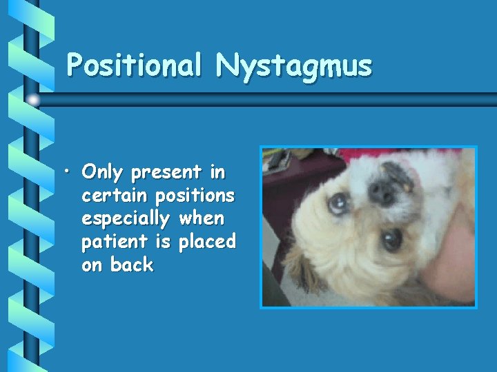 Positional Nystagmus • Only present in certain positions especially when patient is placed on Positional Nystagmus • Only present in certain positions especially when patient is placed on