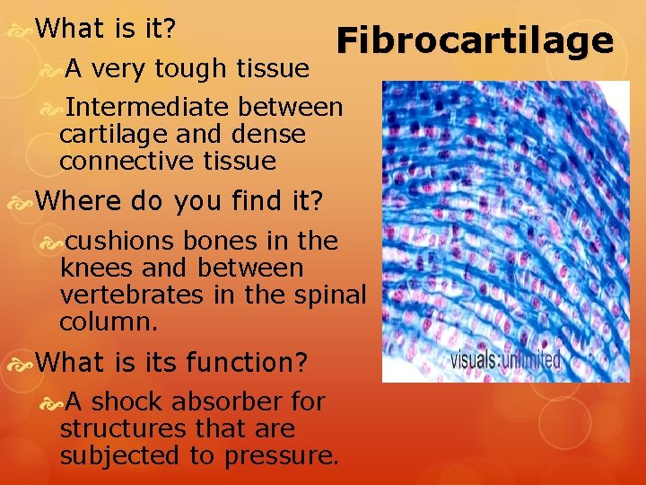  What is it? A very tough tissue Fibrocartilage Intermediate between cartilage and dense