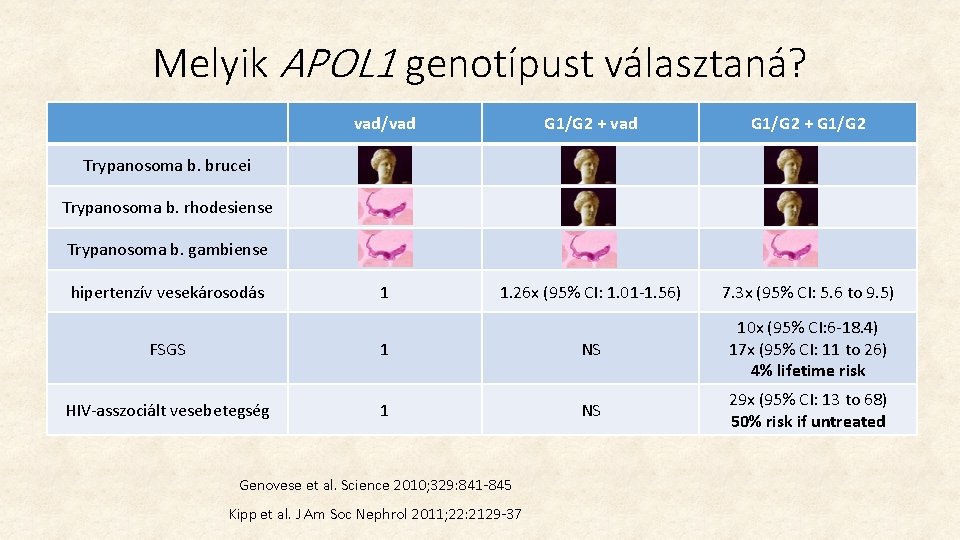 Melyik APOL 1 genotípust választaná? vad/vad G 1/G 2 + G 1/G 2 1 Melyik APOL 1 genotípust választaná? vad/vad G 1/G 2 + G 1/G 2 1