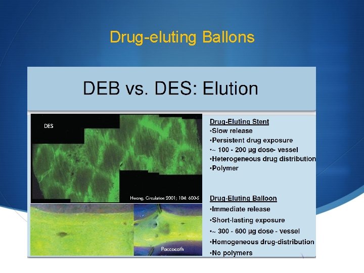 Drug-eluting Ballons 