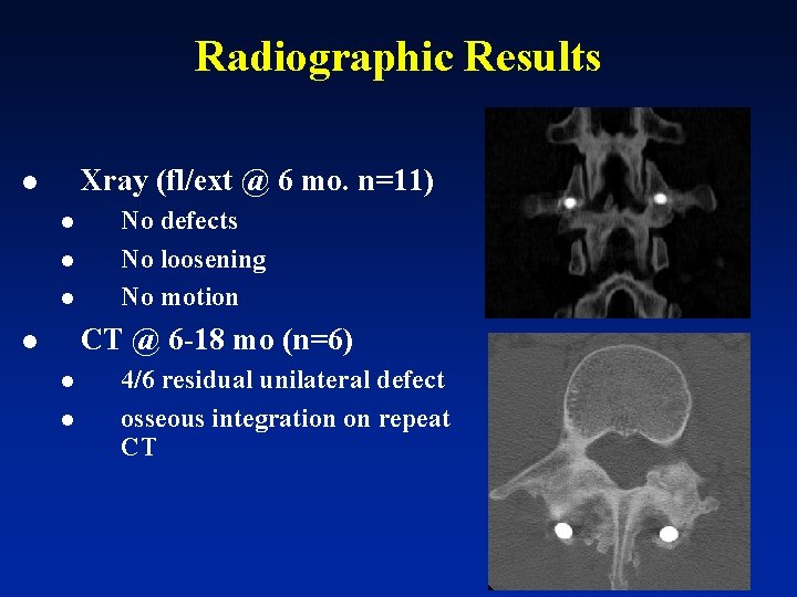 Radiographic Results Xray (fl/ext @ 6 mo. n=11) l l No defects No loosening