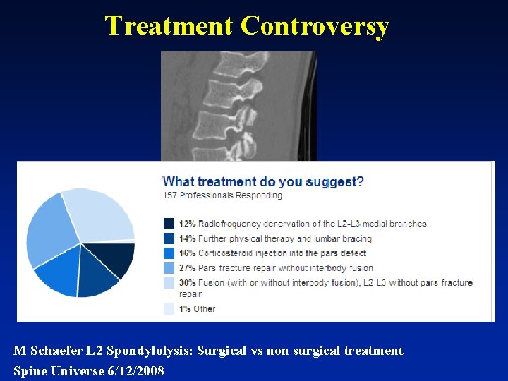 Treatment Controversy M Schaefer L 2 Spondylolysis: Surgical vs non surgical treatment Spine Universe