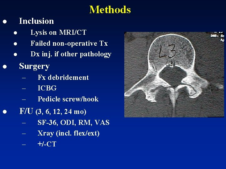Methods Inclusion l Lysis on MRI/CT Failed non-operative Tx Dx inj. if other pathology