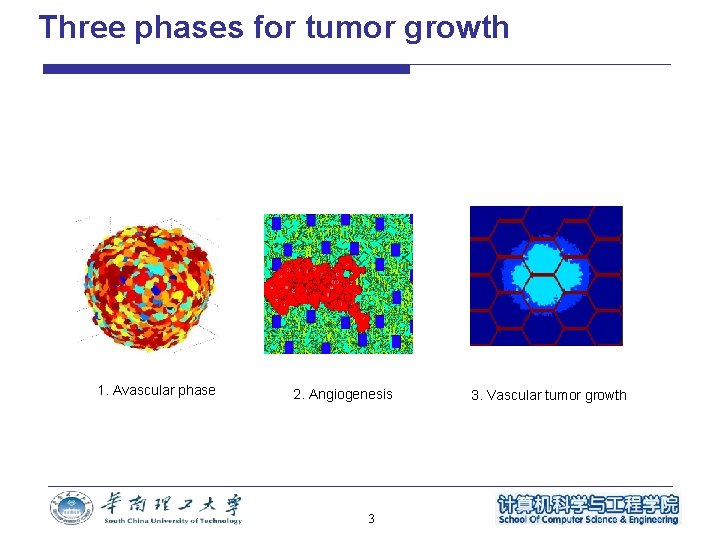 Three phases for tumor growth 1. Avascular phase 2. Angiogenesis 3 3. Vascular tumor