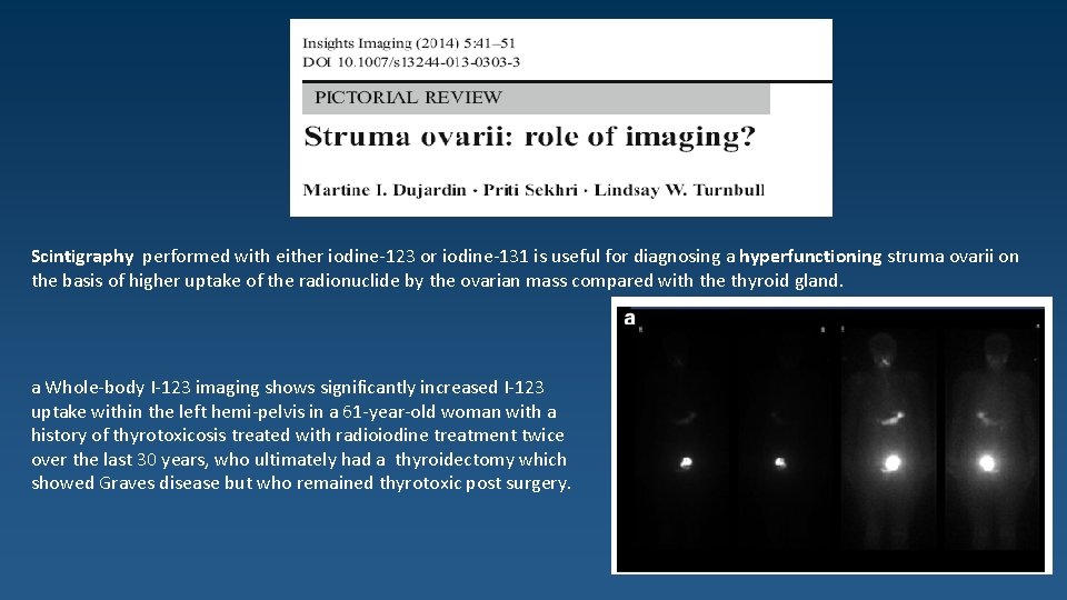 Scintigraphy performed with either iodine-123 or iodine-131 is useful for diagnosing a hyperfunctioning struma