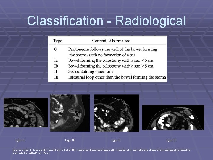 Classification - Radiological type Ia type Ib type III [Moreno-matias J, Serra-aracil X, Darnell-martin