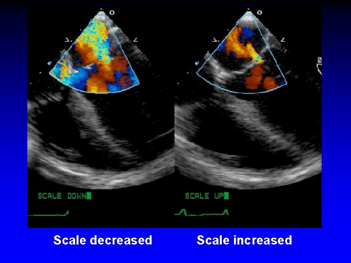 Scale decreased Scale increased Scale decreased Scale increased