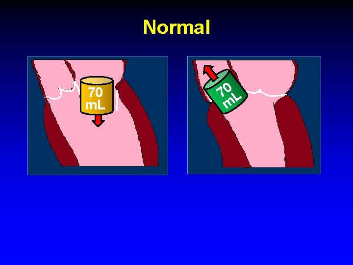Normal 70 m. L 70 L m Normal 70 m. L 70 L m