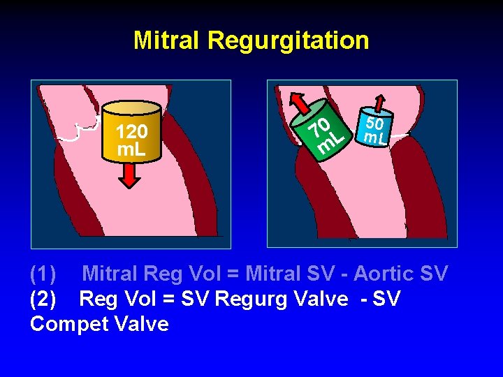 Mitral Regurgitation 120 m. L 50 0 7 L m (1) Mitral Reg Vol Mitral Regurgitation 120 m. L 50 0 7 L m (1) Mitral Reg Vol