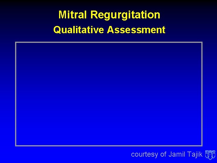 Mitral Regurgitation Qualitative Assessment courtesy of Jamil Tajik Mitral Regurgitation Qualitative Assessment courtesy of Jamil Tajik