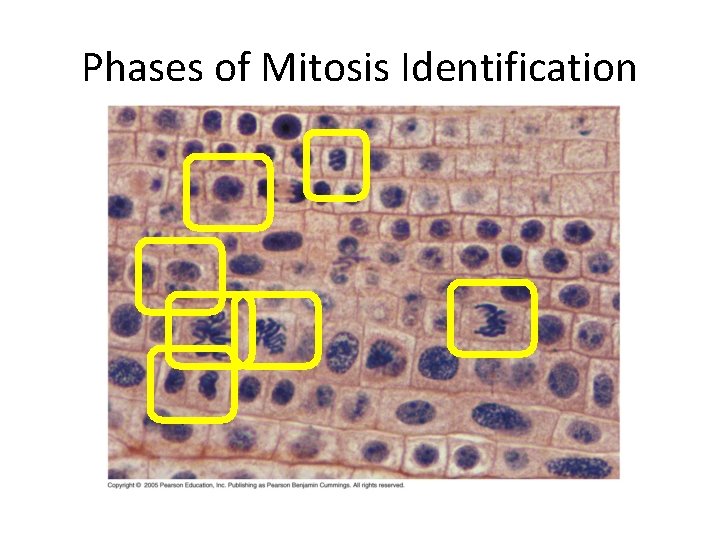 Phases of Mitosis Identification 