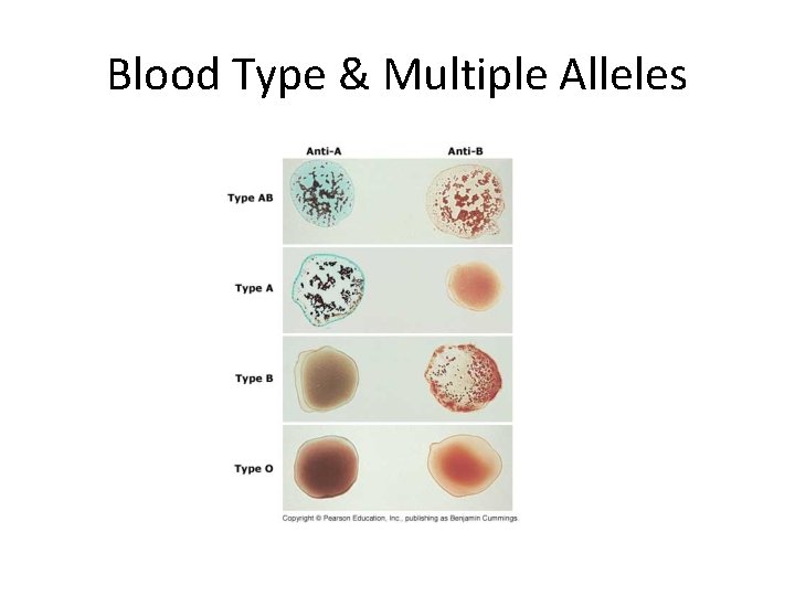 Blood Type & Multiple Alleles 