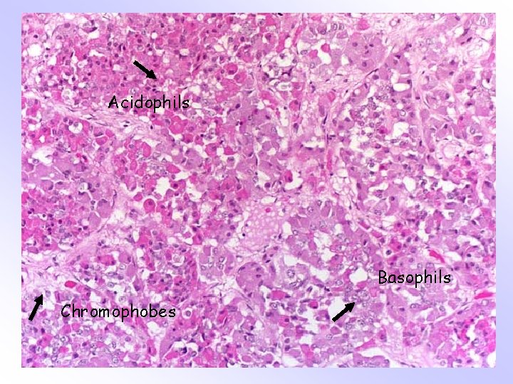 Acidophils Basophils Chromophobes 