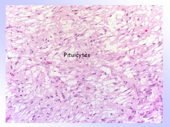 Pituicytes 